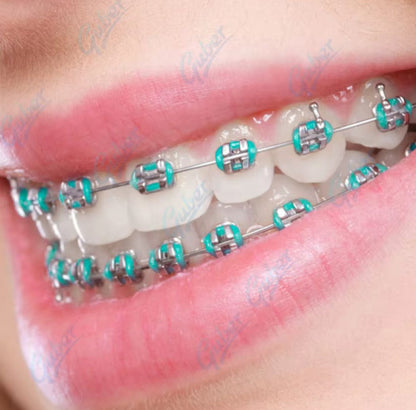 Appareil Dentaire Esthétique – Sourire Stylé & Tendance
