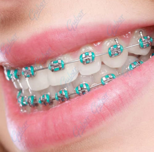 Appareil Dentaire Esthétique – Sourire Stylé & Tendance